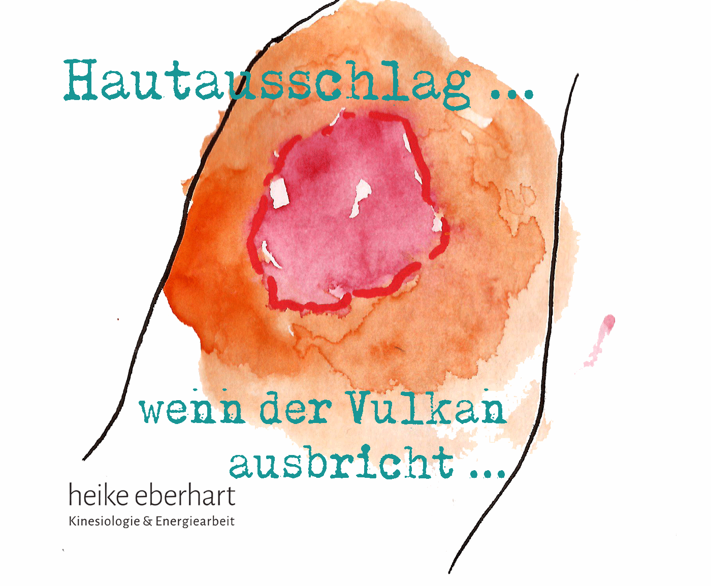 Hautausschlag und Psyche